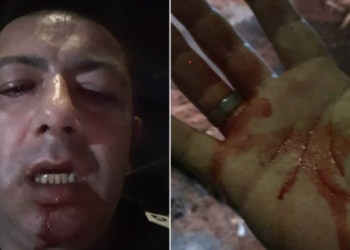 Pino Grazioli Condanne AggressionePino Grazioli Condanne Aggressione