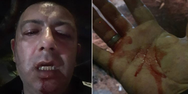 Pino Grazioli Condanne AggressionePino Grazioli Condanne Aggressione