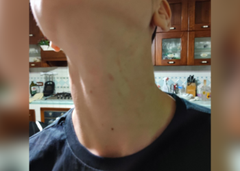 Madre denuncia aggressione subita dal figlio in un centro commerciale