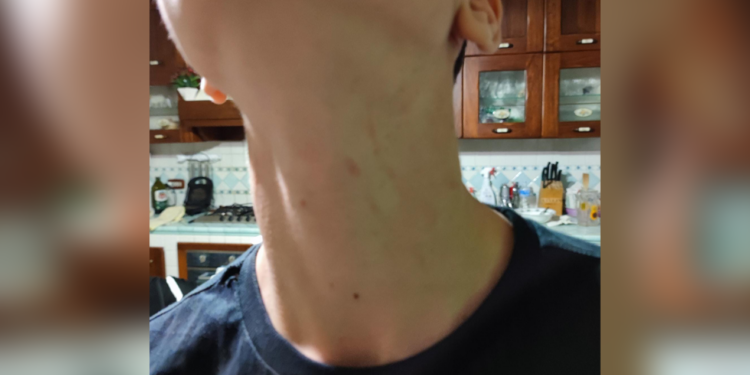 Madre denuncia aggressione subita dal figlio in un centro commerciale