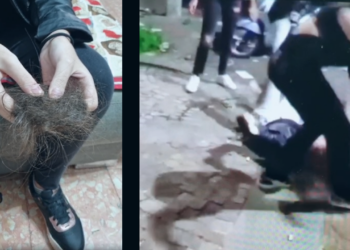 Secondigliano Ragazzina aggredita