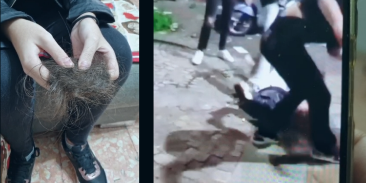 Secondigliano Ragazzina aggredita