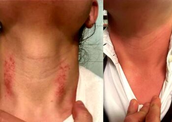 Dottoressa aggredita da accompagnatore paziente: stava per essere uccisa