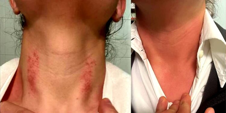 Dottoressa aggredita da accompagnatore paziente: stava per essere uccisa