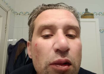 Vomero: preso a pugni perché andava troppo piano