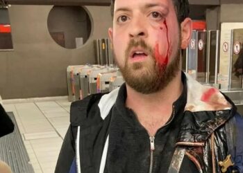 Aggredito selvaggiamente perché filmava le borseggiatrici | Facebook: Pino Grazioli Giornalista