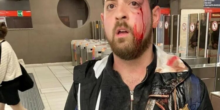 Aggredito selvaggiamente perché filmava le borseggiatrici | Facebook: Pino Grazioli Giornalista