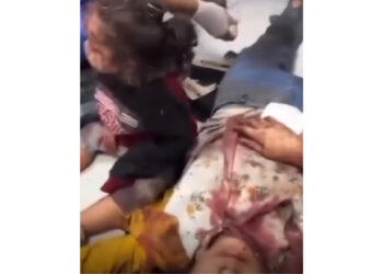 Bambini vittime della guerra