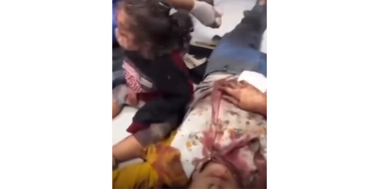 Bambini vittime della guerra