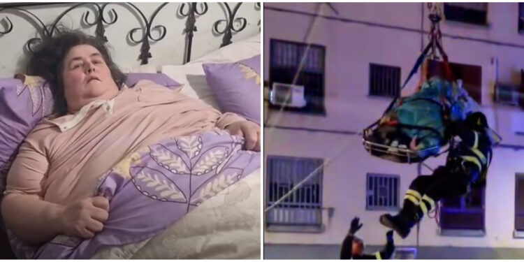 Da 300 kg a 54, donna obesa muore dopo mesi di cure estenuanti