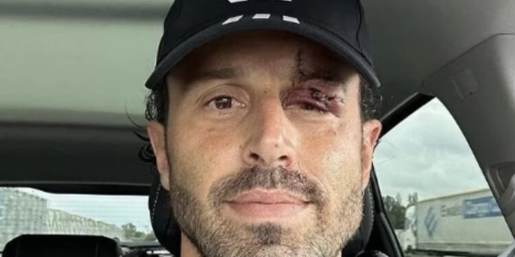 Attacco al pullman del Lione