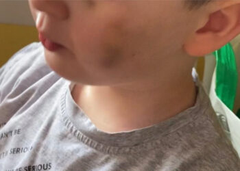 Presunti maltrattamenti in casa famiglia