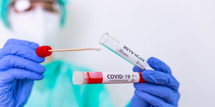 Covid, impennata di casi in Campania