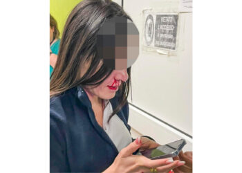 Infermiera aggredita e picchiata violentemente al volto