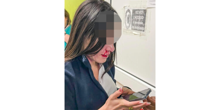 Infermiera aggredita e picchiata violentemente al volto