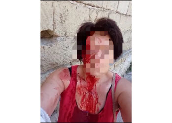 Minacciava e molestava i vicini di casa, 44enne querelato a Frattaminore per condotta violenta