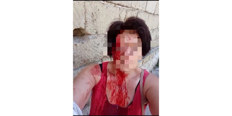 Minacciava e molestava i vicini di casa, 44enne querelato a Frattaminore per condotta violenta