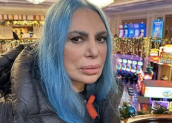 Loredana Berte’ in ospedale, colpita da un improvviso malore addominale
