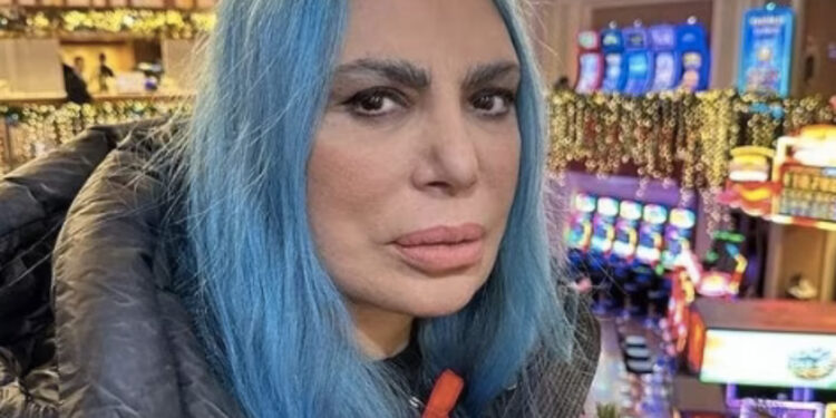 Loredana Berte’ in ospedale, colpita da un improvviso malore addominale