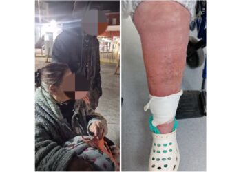 Gambe paralizzate per colpa del freddo: Non avevano accettato l’aiuto di Pino Grazioli