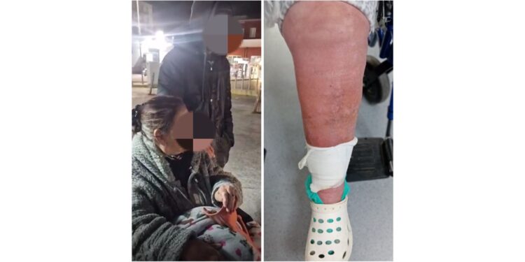 Gambe paralizzate per colpa del freddo: Non avevano accettato l’aiuto di Pino Grazioli