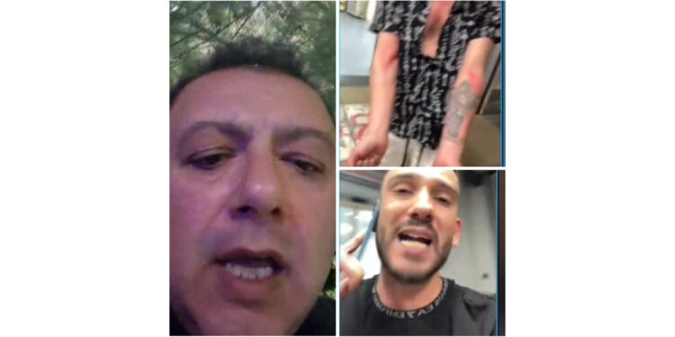 Una bufala  online coinvolge una finta aggressione