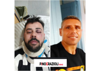 Brutale aggressione da parte  di parcheggiatore  abusivo: Nicola di Giovanni smascherato