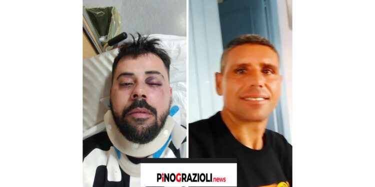 Brutale aggressione da parte  di parcheggiatore  abusivo: Nicola di Giovanni smascherato