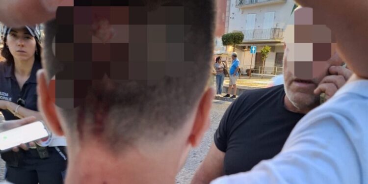 Tragedia sfiorata a Pozzuoli: palo della segnaletica stradale cede e colpisce un 12enne