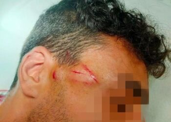 Napoli: escalation di violenza, aggredito con il calcio di una pistola