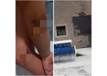 A Monteruscello bimba cade in un tombino, nessun intervento per la messa in sicurezza da parte del comune