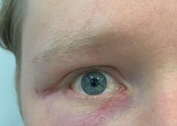 Serata di terrore a Napoli: tre fratelli aggrediti e rapinati a Piazza Nicola Amore