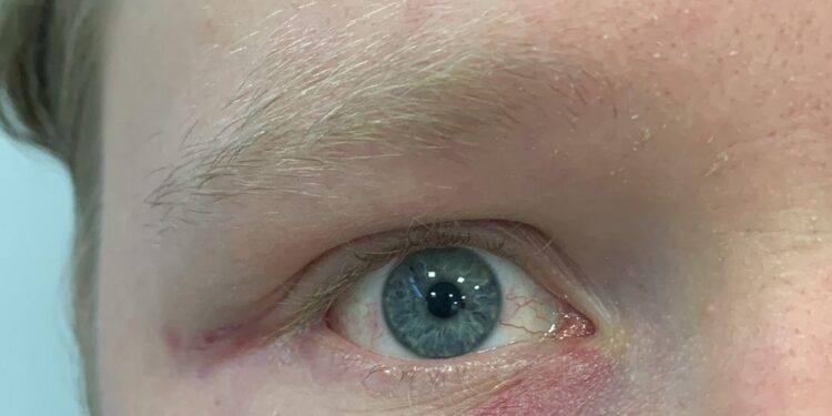 Serata di terrore a Napoli: tre fratelli aggrediti e rapinati a Piazza Nicola Amore