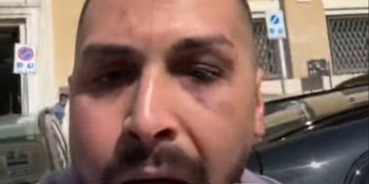 Napoli: minacciato e rapinato, ragazzo chiede giustizia attraverso un video