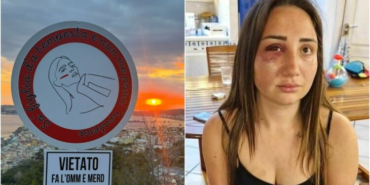 Pozzuoli: vandalizzato il cartello a sostegno di Gaia, la ragazza picchiata dal fidanzato