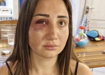 “Se non mi fossi ribellata, mi avrebbe gettata giù”: Gaia racconta l’orrore della violenza subita