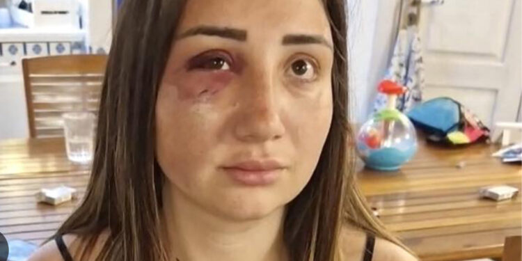 “Se non mi fossi ribellata, mi avrebbe gettata giù”: Gaia racconta l’orrore della violenza subita