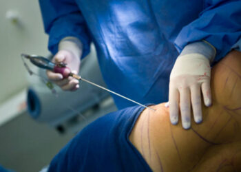 Sabrina N., tragedia a Caserta: muore dopo un intervento estetico, indagini in corso