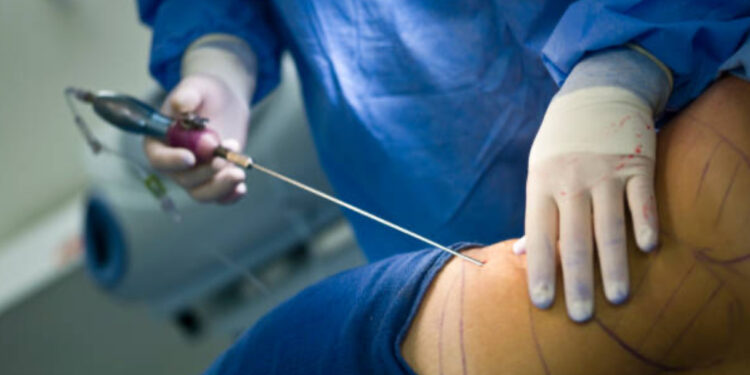 Sabrina N., tragedia a Caserta: muore dopo un intervento estetico, indagini in corso