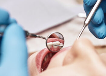 Il “Dentista Fai-da-Te” del Web: 160.000 euro di sorrisi (Amari) e tutorial online