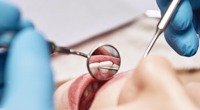 Il “Dentista Fai-da-Te” del Web: 160.000 euro di sorrisi (Amari) e tutorial online