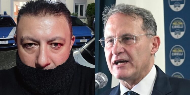 Edmundo Cirielli interviene per l’accaduto ed esprime solidarietà al giornalista Pino Grazioli.